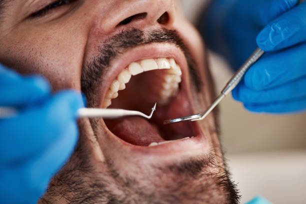 Best Emergency Treatment for Dental Infections or Abscesses in Clute, TX