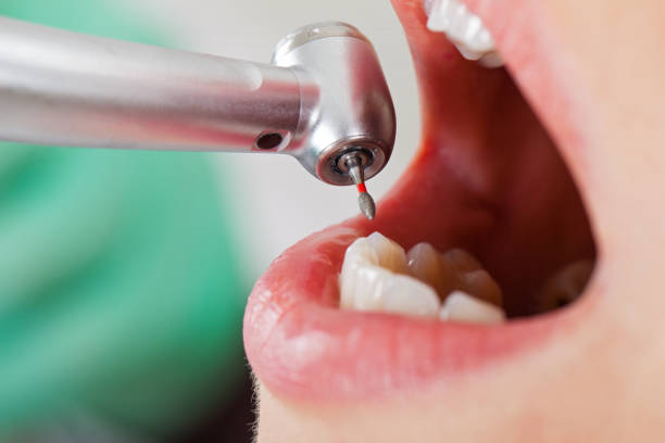 Best Same-Day Emergency Dental Services in Clute, TX